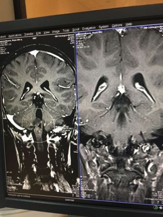 Мать 8-летней Ройи Имамвердиевой: «Нам уже нечего продавать. Но я буду бороться за жизнь дочери до последнего»