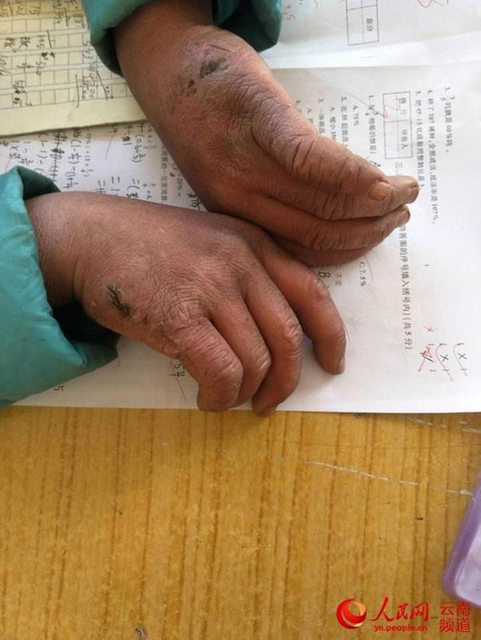 Волосы 10-летнего школьника заледенели, пока он шёл 5 км, чтобы успеть на урок - ФОТО